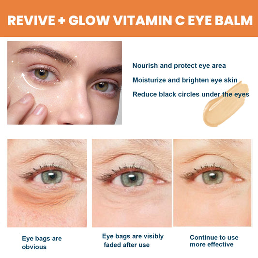 Vitamin C Eye Balm - Dark Circle & Puffiness Treatment